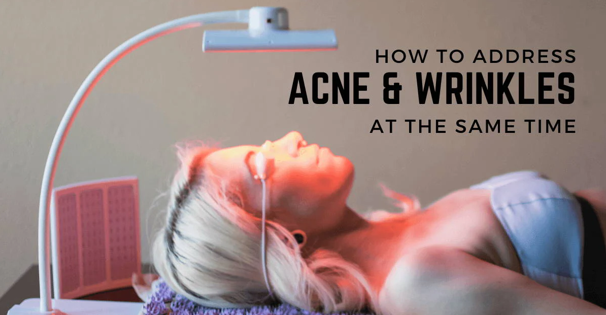 How To Address Acne & Wrinkles At The Same Time